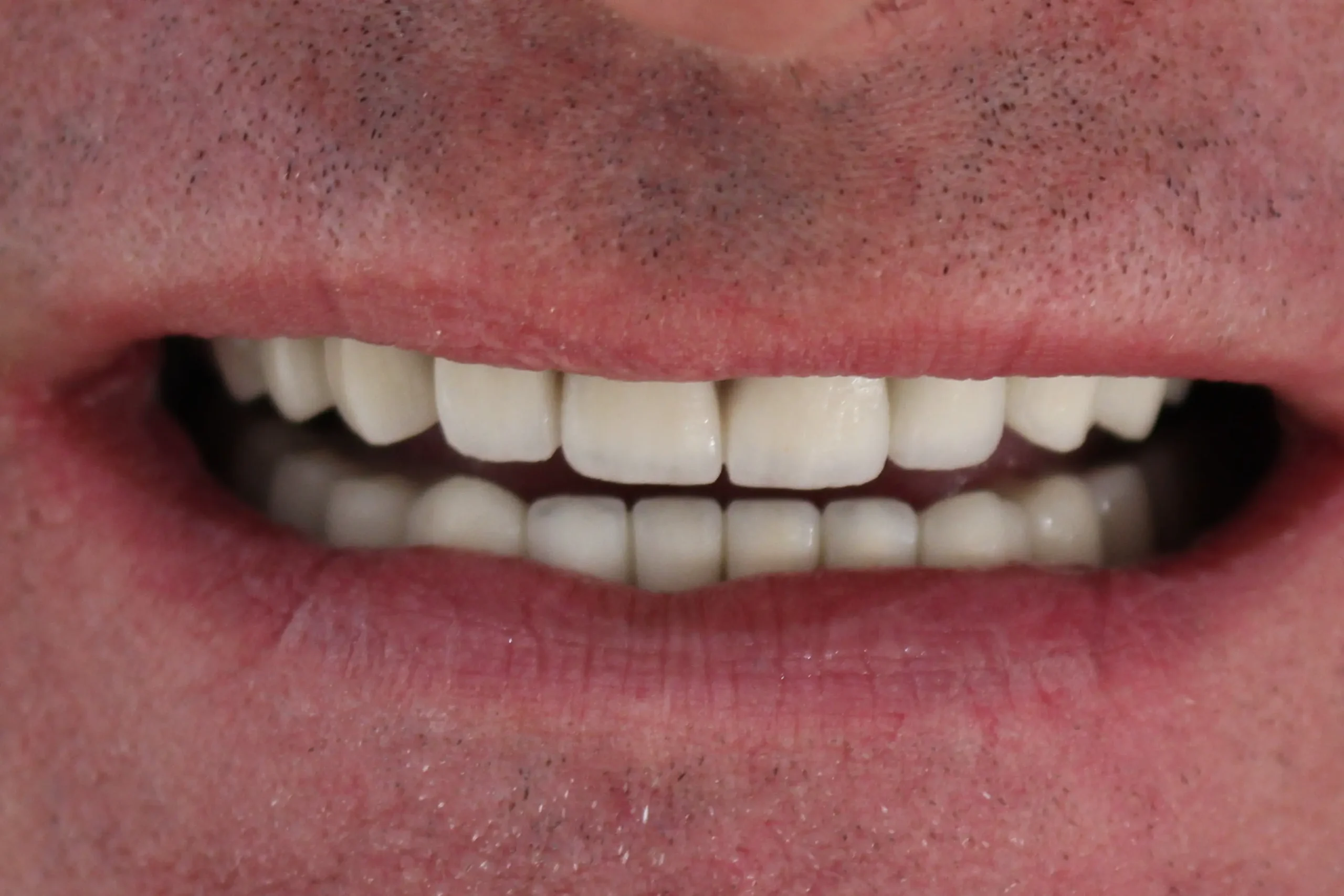 Slike_0002_5-poslije