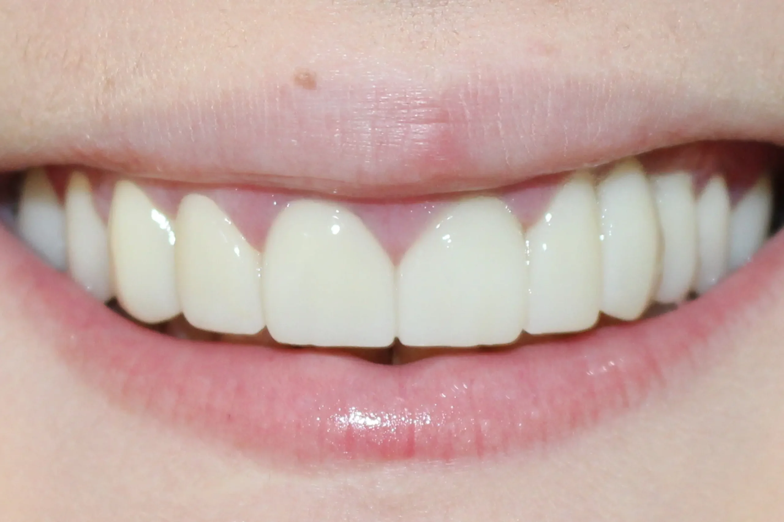 Slike_0004_4-poslije