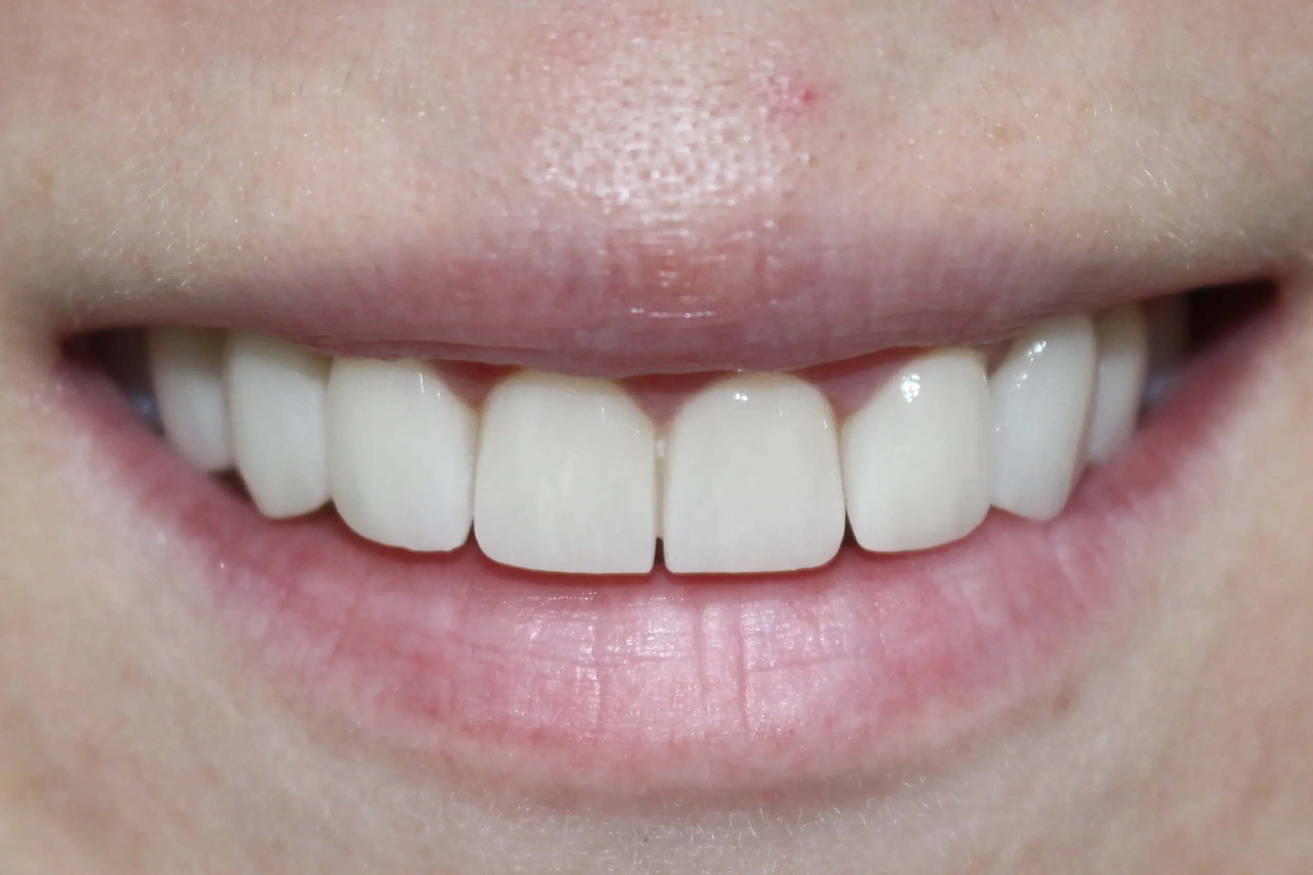 Slike_0006_3--poslije