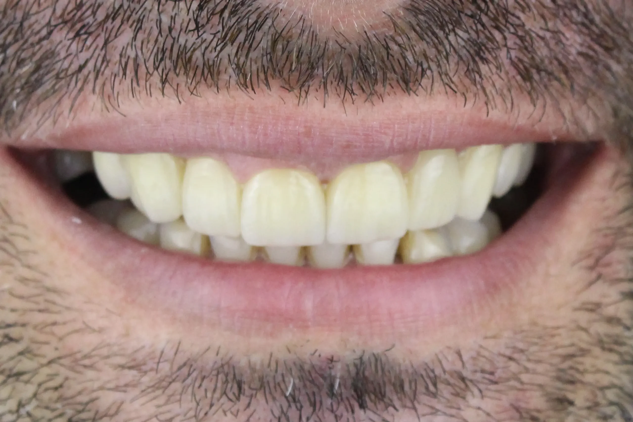 Slike_0008_2-poslije